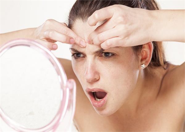 PunjabKesari, Pimples, पिंपल्स, Beauty secrets, पिपंल के कारण
