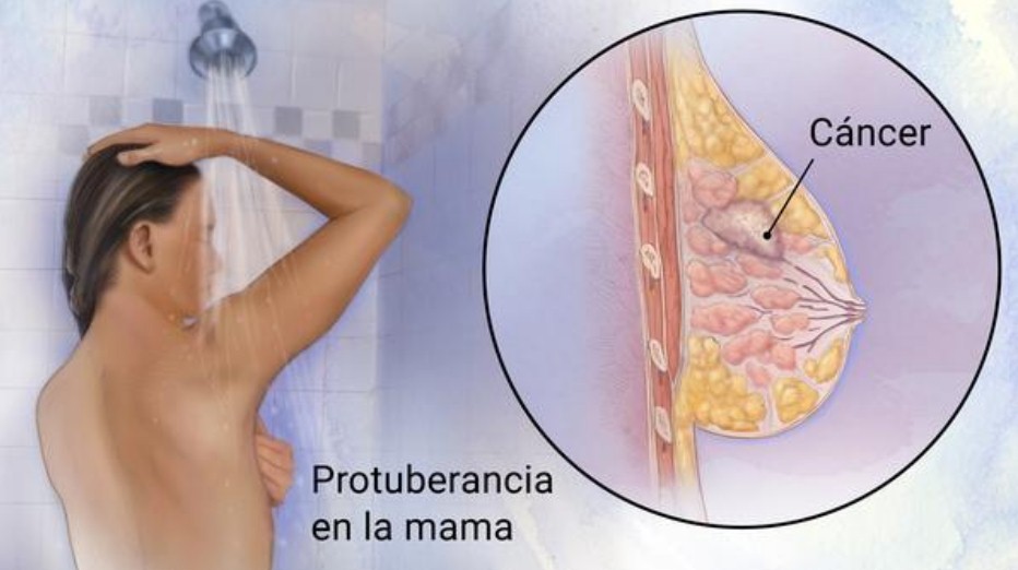PunjabKesari, Women Health Image, Breast Cancer Image, ब्रेस्ट कैंसर का खतरा इमेज