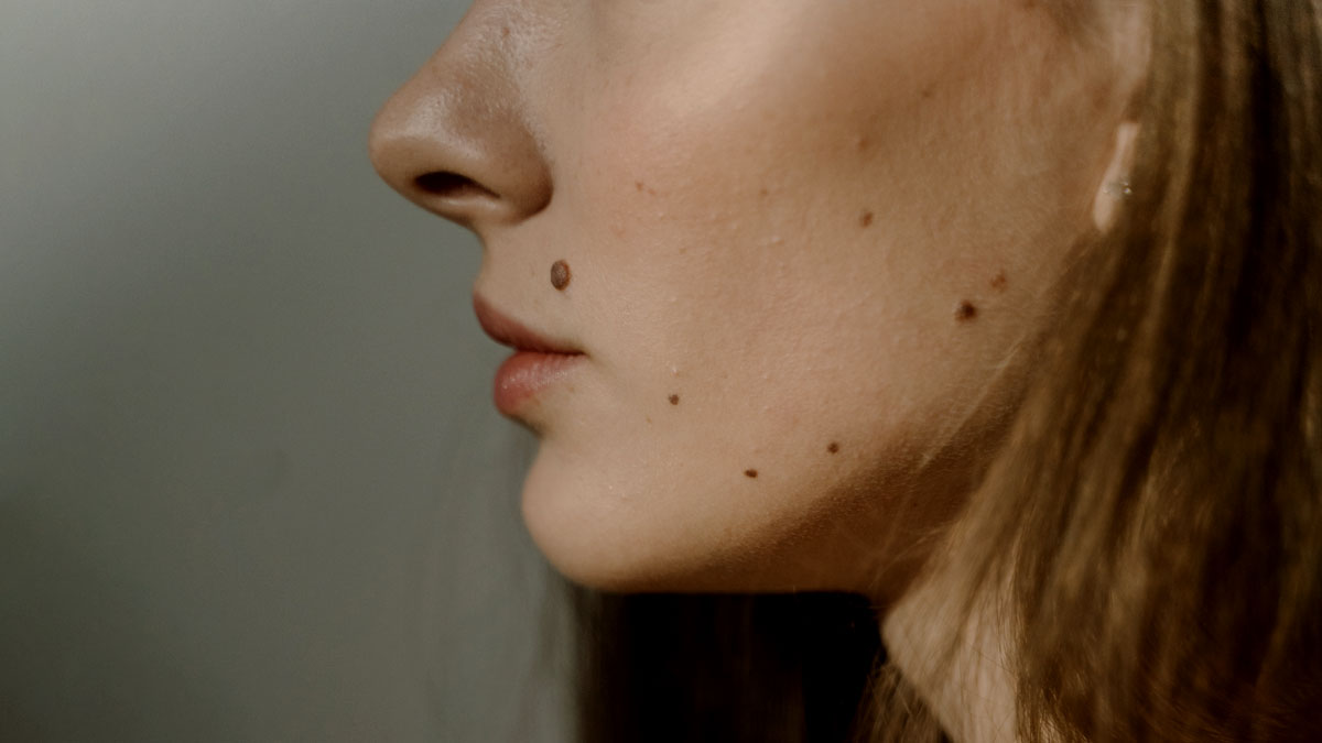 Mole on cheek meaning