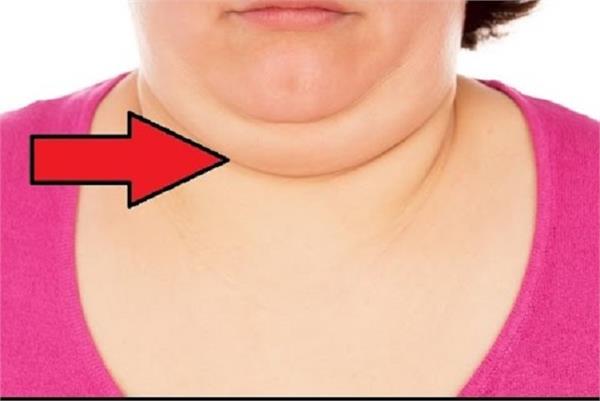 यूं करें डबल चिन की समस्या को दूर