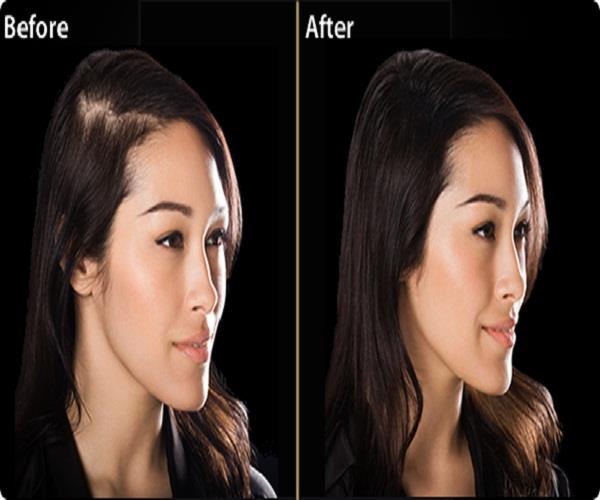 Dermatologists ने दी 6 शैंपू लगाने की सलाह, बालों का झड़ना होगा बंद