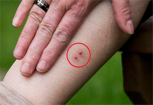 सांप के काटने पर तुरंत करें ये असरदार घरेलू उपचार