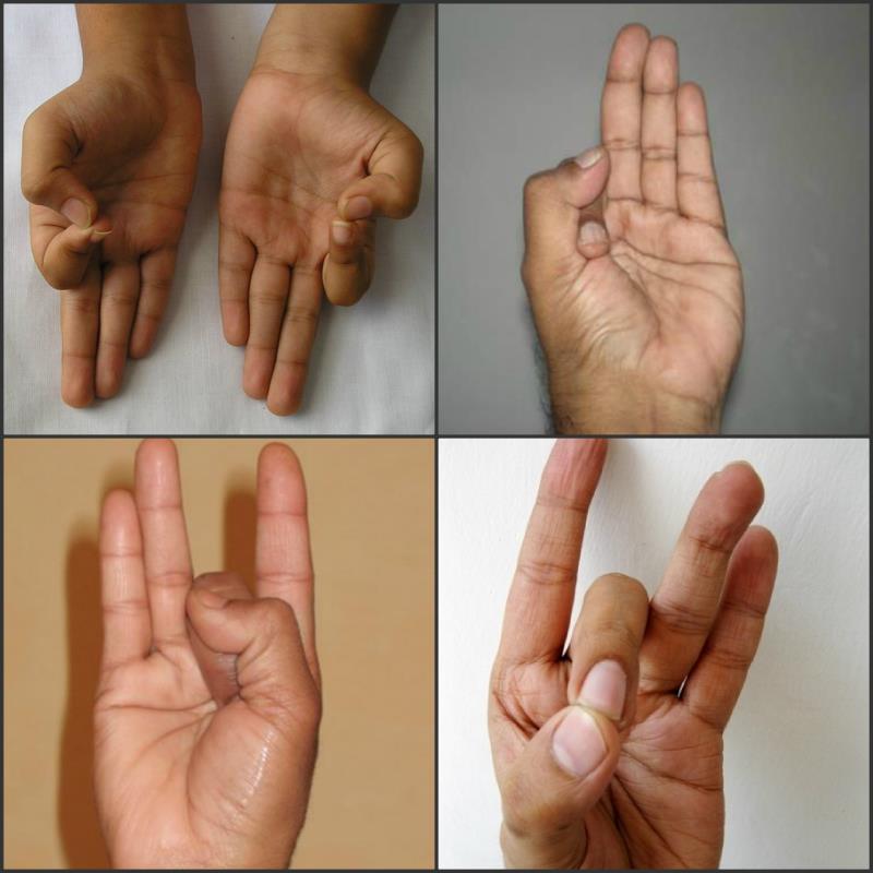 हाथ की मुद्राओं से करें बीमारियों का इलाज