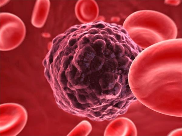 अब ट य मर स ल स क ग र ड ग स ह ग प ज आई म क सर क इल ज Tumor Cells