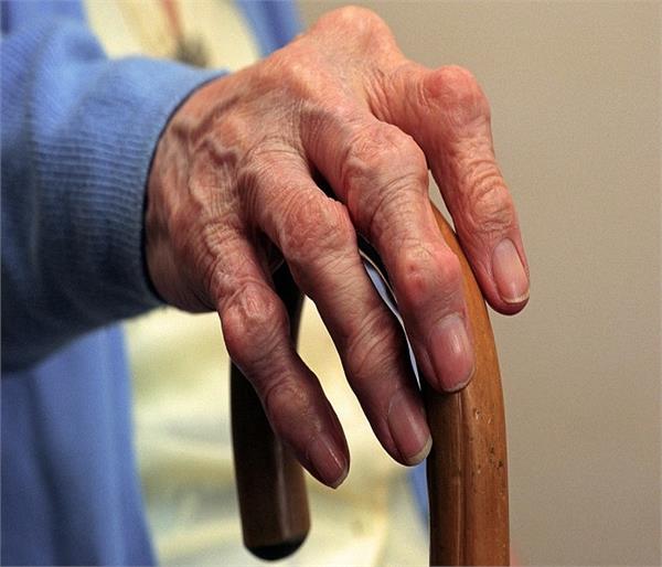 बड़े हुए यूरिक एसिड को कम करे ये आसान घरेलू उपाए