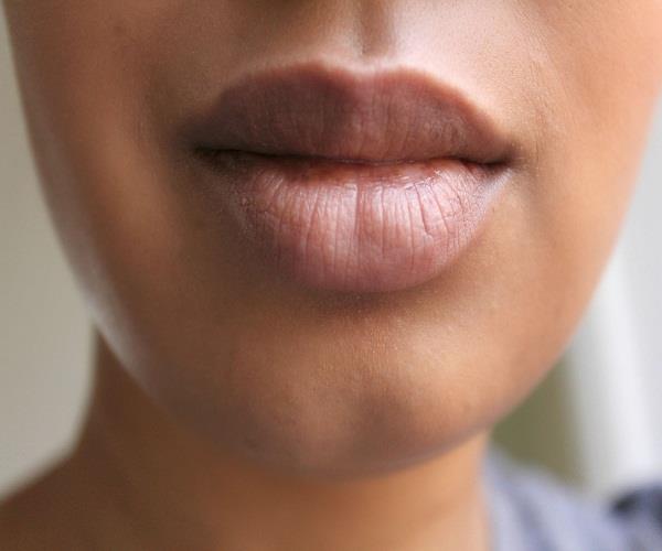 काले होठों को सॉफ्ट गुलाबी करने के उपाय