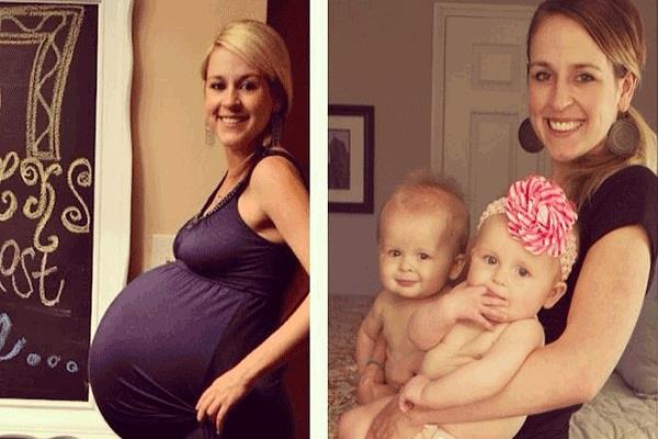 जुड़वां बच्चे होने पर दिखते हैं ये लक्षण!