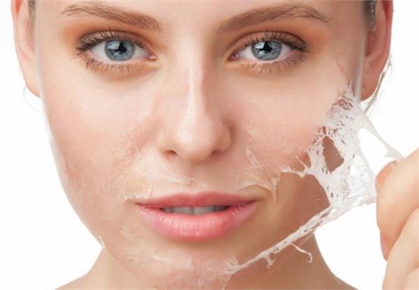 Skin Peeling के लिए बड़े असरदार हैं ये नुस्खे