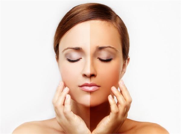 सन टैनिंग से मिलेगी राहत, अपनाएं ये घरेलू नुस्खे