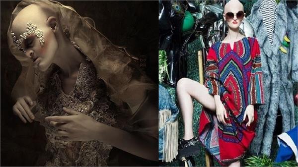 पुतला नहीं, महिला है अमेरिका की यह 'टॉप मॉडल', इस कारण हो गया ये हाल