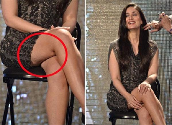 आपको भी शर्मिंदा करती है ढीली स्किन तो अपनाएं ये असरदार टिप्स