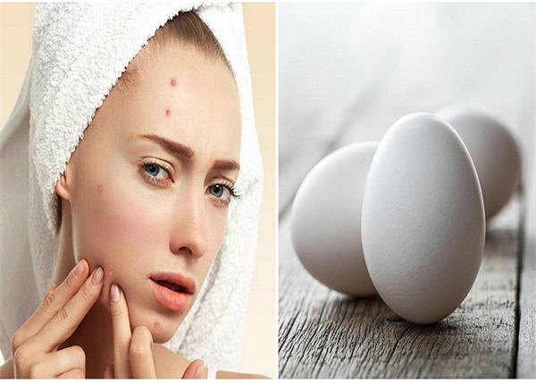 क्या एक्ने वाली स्किन पर अंडा लगाना सही होगा