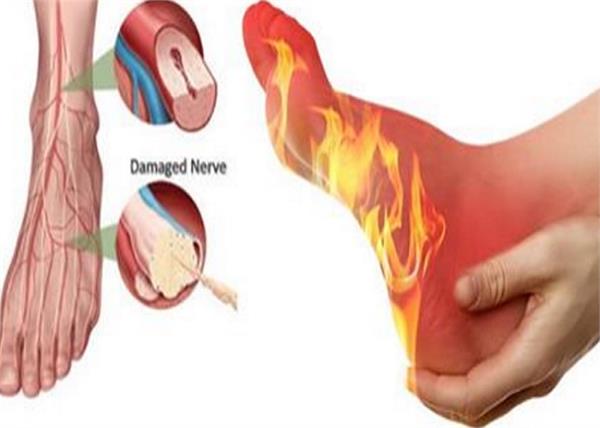 पैरों में जलन की दवा है यह आयुर्वेदिक तेल