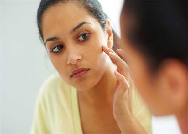 खुले पोर्स को किचन की चीजों से करें बंद - Nari