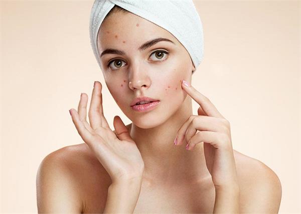 पिंपल्स और एक्ने से बचने के लिए लें बैलेंस डाइट