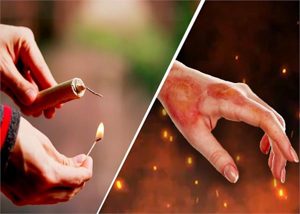 दिवाली के पटाखों से जल जाए हाथ-पैर तो तुरंत करें ये काम