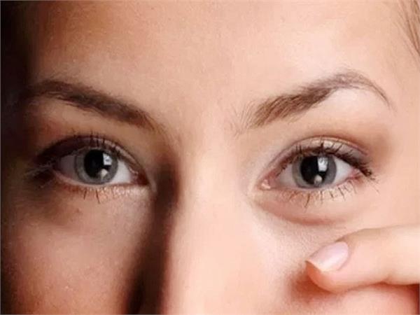 पफी आईज का कारण है यह प्रॉबल्म, ठीक करेंगे ये 3 घरेलू टिप्स