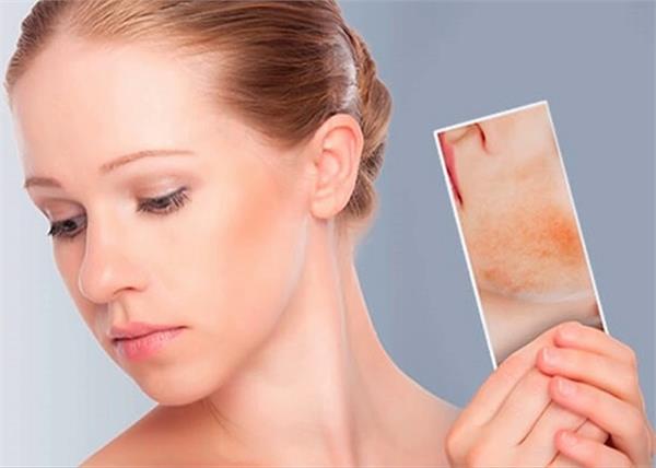 क्यों होते हैं स्किन पिग्मैंटेशन और कैसे करें इलाज?