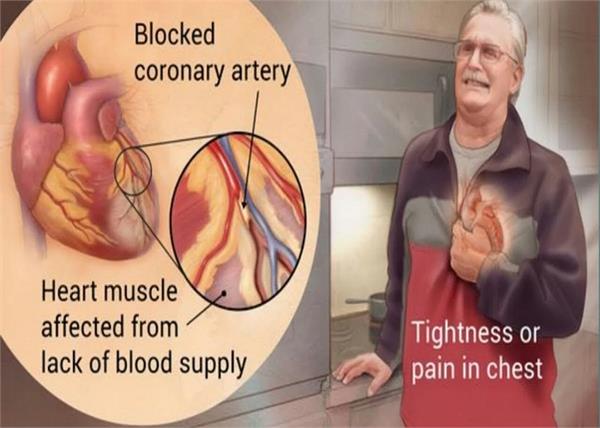 हाई कोलेस्ट्रॉल से कभी भी आ सकता है Heart Attack, ऐसे करे कंट्रोल