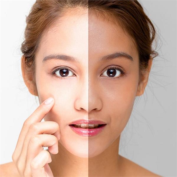 Beauty: दादी-मां के घरेलू उबटन से पाएं गोरी व बेदाग त्वचा
