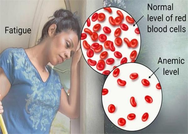 80% औरतों में खून की कमी, बिना दवा कमी पूरा करने का तरीका जानें