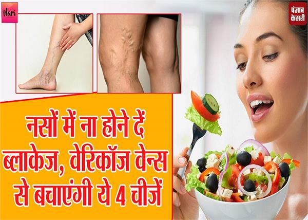 नसों में ना होने दें ब्लॉकेज, वेरिकाज वेन्स से बचाएंगी ये 4 चीजें