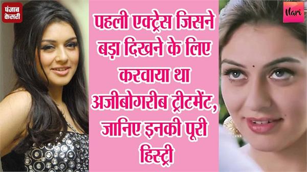 पहली एक्ट्रेस जिसने बड़ा दिखने के लिए करवाया था अजीबोगरीब ट्रीटमेंट, जानिए इनकी पूरी हिस्ट्री