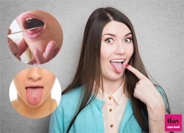 अंदर ही अंदर आपको खा रही गंभीर बीमारियां, जीभ का रंग बताएगा सेहत का राज