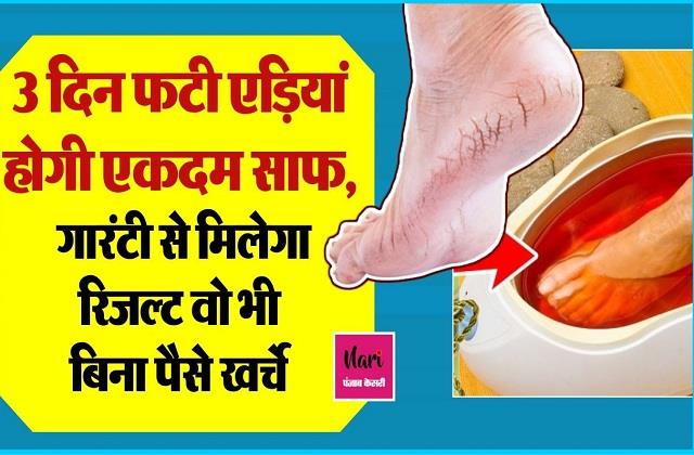 सिर्फ 3 दिन में फटी एड़ियां हो जाएगी एक दम सॉफ्ट, 100% मिलेगा नुस्खे का रिजल्ट