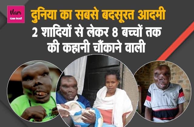 'पैदा होते ही मेरी मां ने मुझे छोड़ दिया', दुनिया का सबसे बदसूरत आदमी Godfrey Baguma