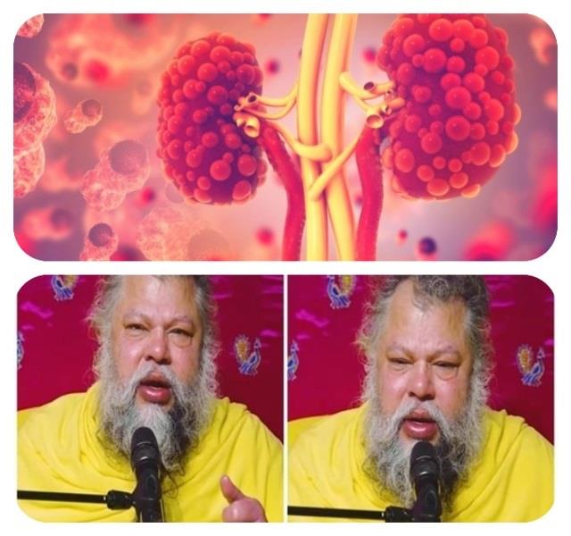 सूजी आंखें, लाल मुंह...देख रोने लगे भक्त,आखिर कौन-सी बीमारी से जूझ रहे हैं प्रेमानंद जी?