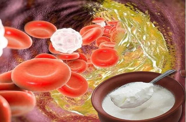 देसी नुस्खा! मल के साथ बाहर निकल जाएगा Bad Cholesterol, दही में मिलाकर खा लें ये चीज़