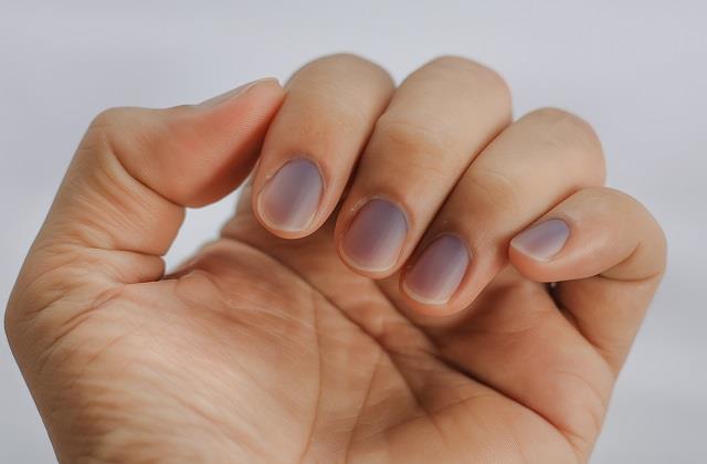 नाखूनों में बार-बार दिखें ये बदलाव तो समझ लें शरीर में चल रही कोई बड़ी गड़बड़ी