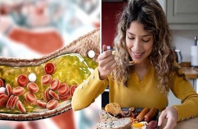 शरीर में भर गया गंदा Cholestrol, ये 6 लक्षण आखिरी चेतावनी, डॉक्टर ने बताया कैसे निकलेगा ये ‘पीला कचरा’