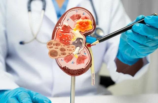 किडनी Transplant के बाद पुरानी किडनी का क्या होता है? सच्चाई जानकर उड़ जाएंगे होश