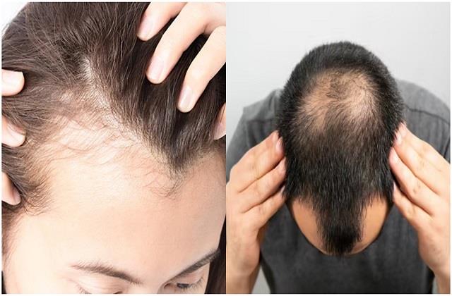 गंजापन दूर कर सकता है ये एक योगासन, चंद दिनों में उगने लगेंगे नए बाल!