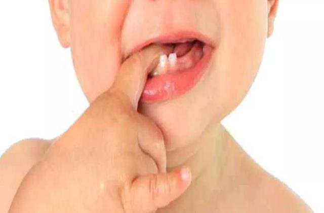 मुंह की जगह 4 साल के बच्चे के नाक में उगा दांत, 6 महीने से दर्द में तड़पता रहा मासूम