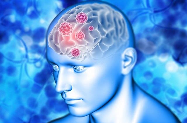 Brain में Clot होने के संकेत, लापरवाही की तो अचानक ही निकल जाएगी जान!