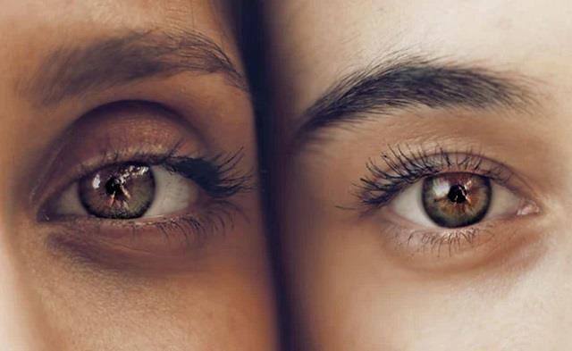 2 दिन में डार्क सर्कल्स गायब करेगा आलू का मास्क, घर पर करें आसान नुस्खा