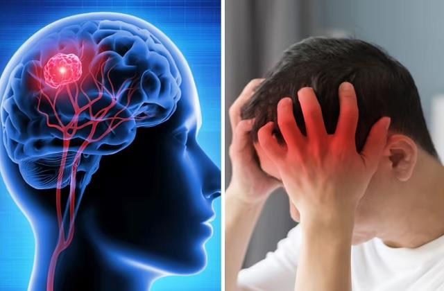 दिमाग में सुन्नपन रहने पर ये लक्षण दिखते हैं ? ऐसा होने के बड़े कारण भी जानिए
