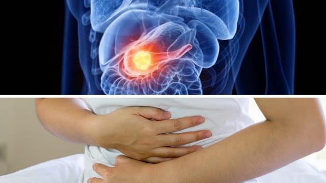 लगातार थकान और कमर-पेट में दर्द हो सकता है पैंक्रियाटिक कैंसर का संकेत, डॉ. की चेतावनी इग्नोर न करें