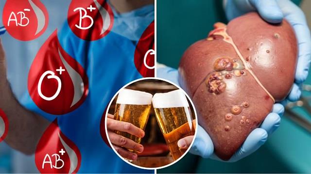 इस ब्लड ग्रुप में तेजी से बढ़ रहा है लिवर डिजीज का रिस्क! कहीं आपका BG यह तो नहीं, तुरंत कर लीजिए चेक