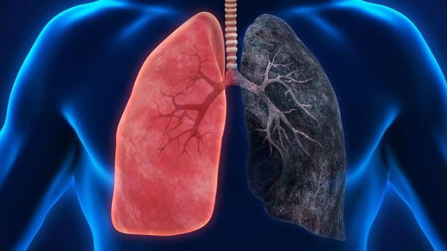 पैरों में दिखते हैं Lung Cancer के शुरुआती संकेत, इन लक्षणों को न करें नजरअंदाज