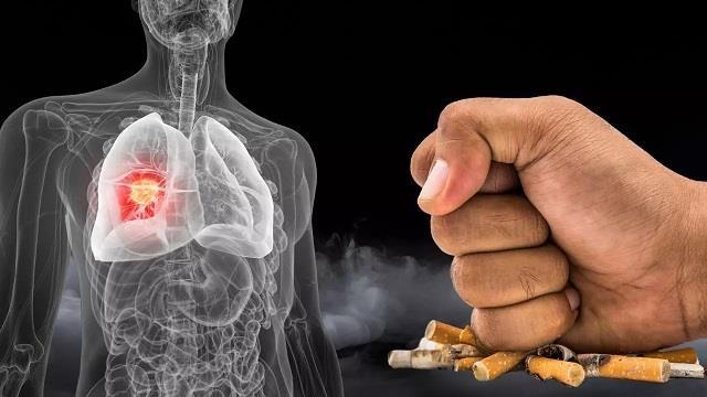 सिगरेट और शराब से ज्यादा खतरनाक ये 4 Foods, Lung Cancer की सबसे बड़ी वजह!