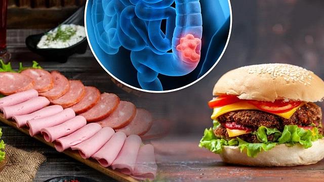 “सावधान! ये खाने की चीजें बढ़ा सकती हैं आंत के कैंसर का खतरा, रिसर्च में हुआ बड़ा खुलासा”