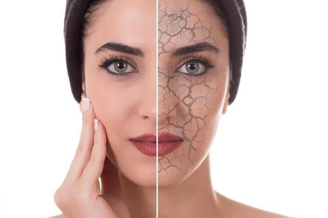 सर्दियों में ड्राई स्किन? अपनाएं ये घरेलू नुस्खे, पाएं हेल्दी और मॉइश्चराइज्ड त्वचा