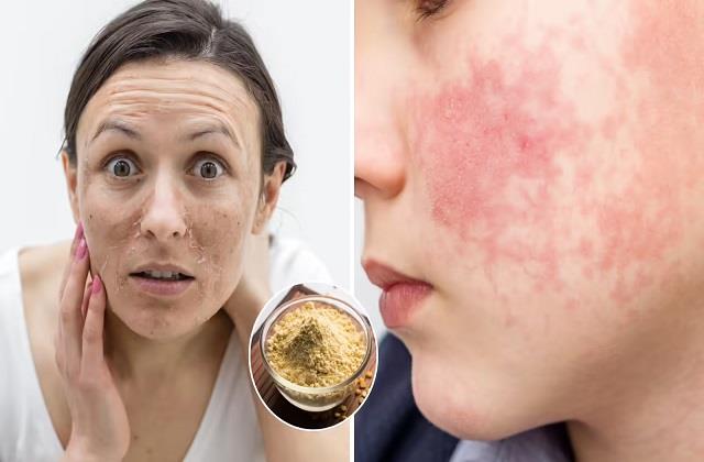 देसी नुस्खा आपकी स्किन को कर सकता है बर्बाद, वजह कर देगी हैरान!