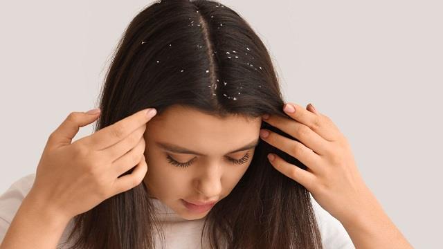 सर्दियों में बाल धोने के बावजूद डैंड्रफ नहीं जा रहा? अपनाएं ये आसान उपाय, जल्दी मिलेगा आराम!