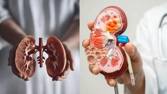 ये 5 Signal दिखें तो समझ लें किडनी खतरे में,  तुरंत करवाएं जांच