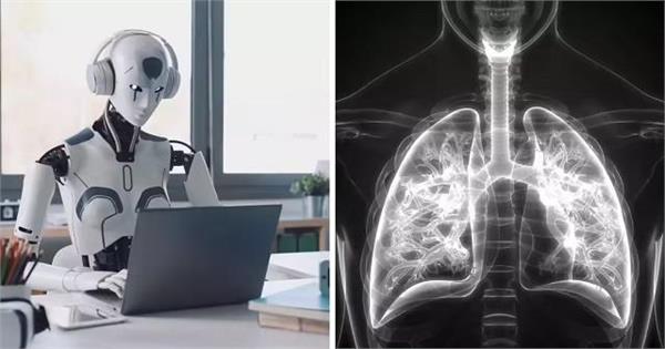 AI ने खोजा TB रोकने का नया तरीका, अब नहीं जाएगी बेवक्त जान!